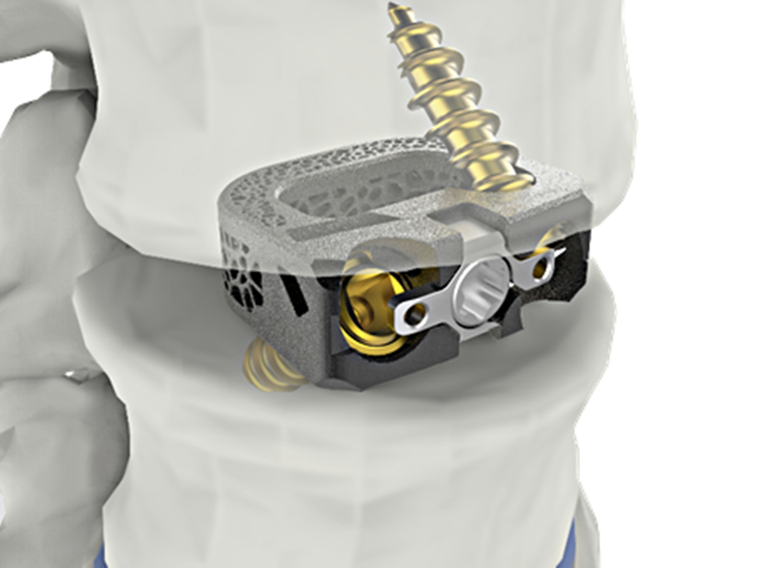 사진=시지메드텍.