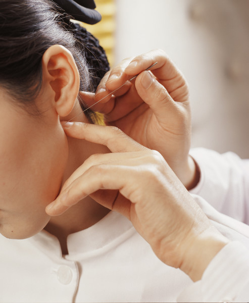 한 여성이 턱 관절에 침 치료를 받고 있다. 출처=자생한방병원