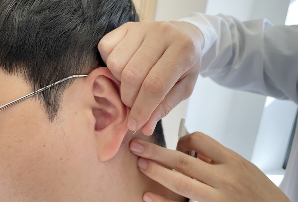 자생한방병원 의료진이 이명 환자에게 침치료를 하고 있다. 출처=자생한방병원