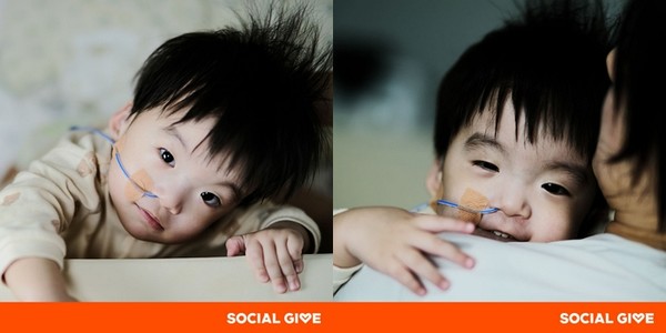 희귀 난치성 질환인 '차지증후군'을 앓는 은우. 사진=티몬