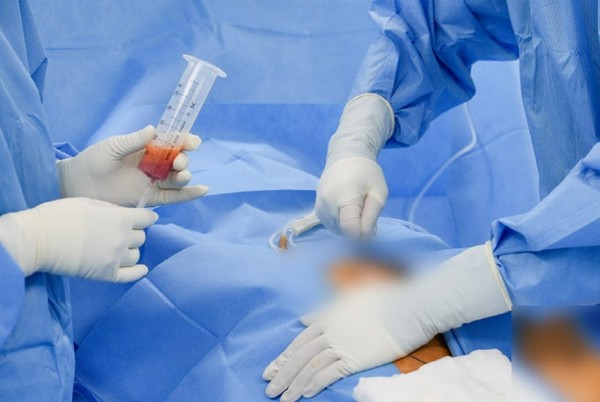 연세사랑병원 의료진이 환자의 수면마취 하에 환자 자신의 몸에 있는 지방조직을 채취하고 있다