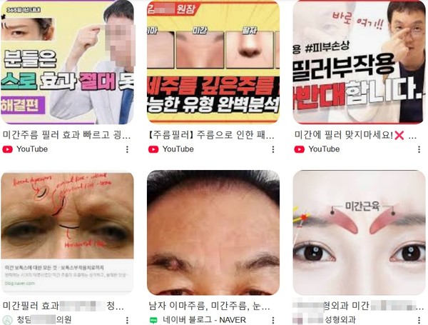5일 오후 포털 사이트에서 미간 필러를 검색하자 관련 홍보 콘텐츠와 부작용을 알리는 콘텐츠가 함께 검색됐다. 사진=포털 사이트 캡처